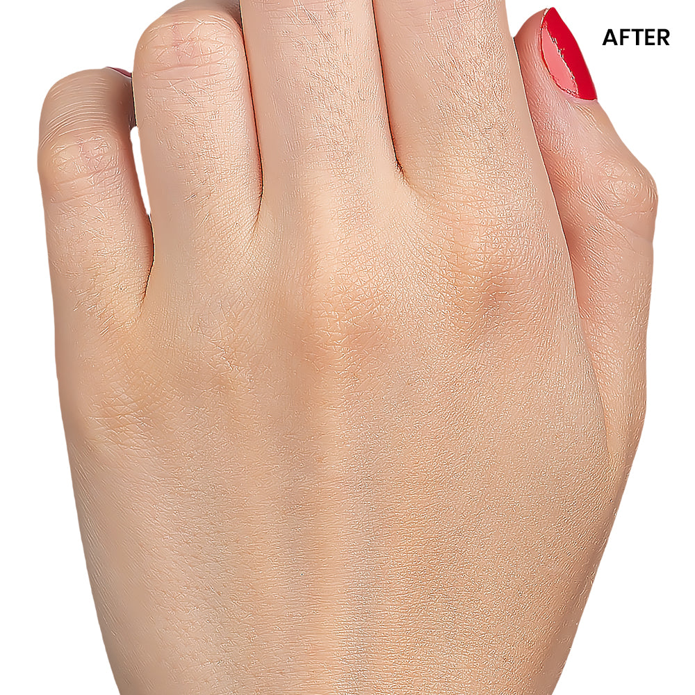 image comparison after