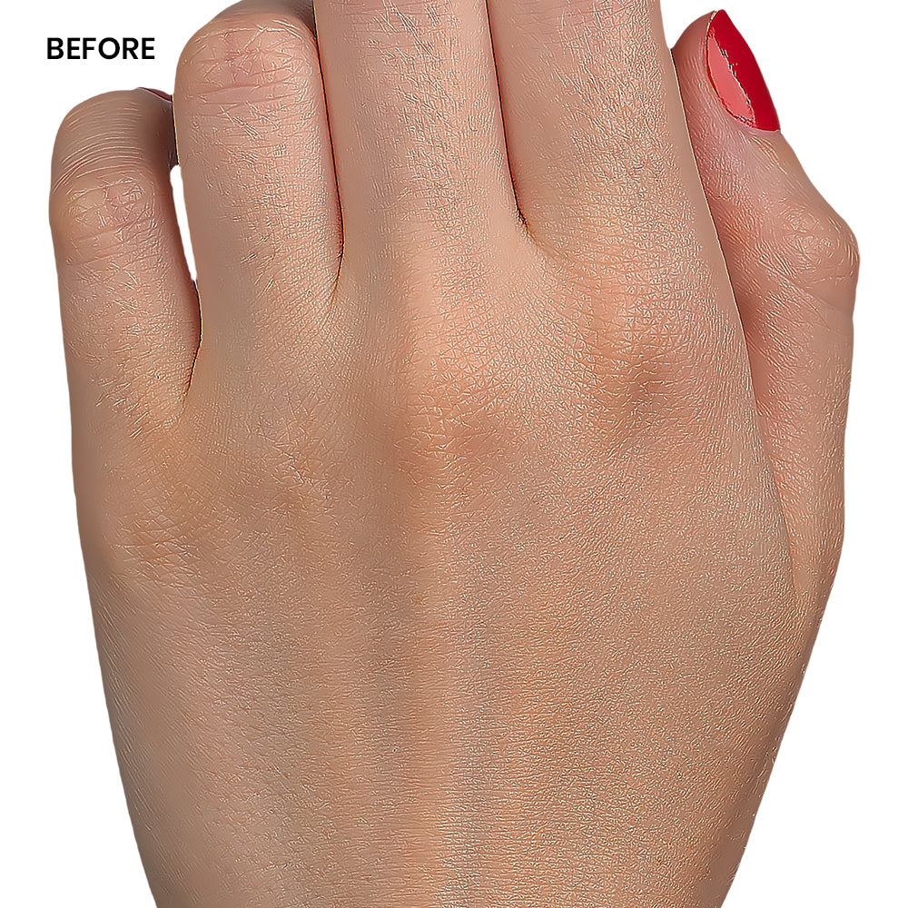 image comparison before